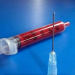 stem cells back pain